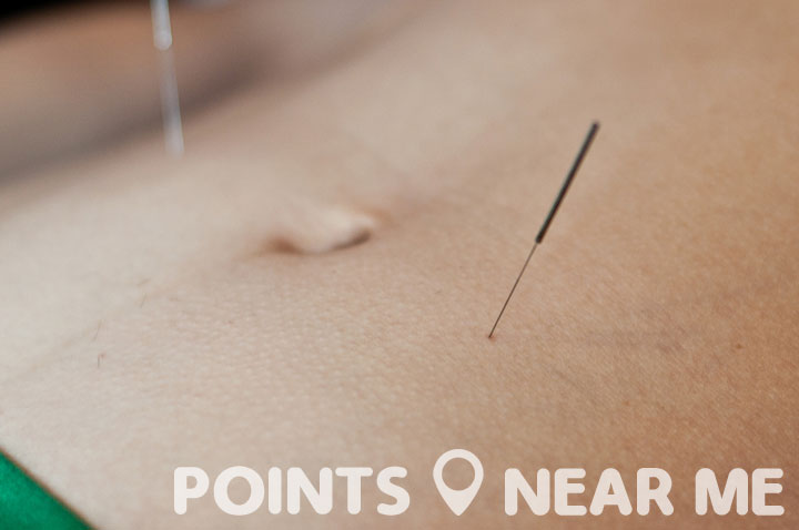ACUPUNCTURE NEAR ME - Points Near Me