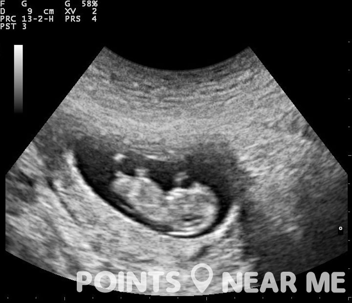 ultrasound near me