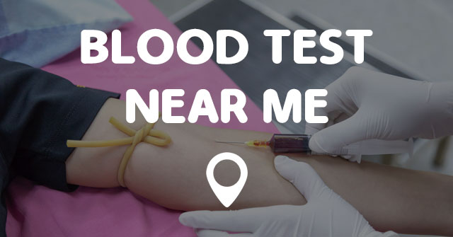 BLOOD TEST NEAR ME - Points Near Me
